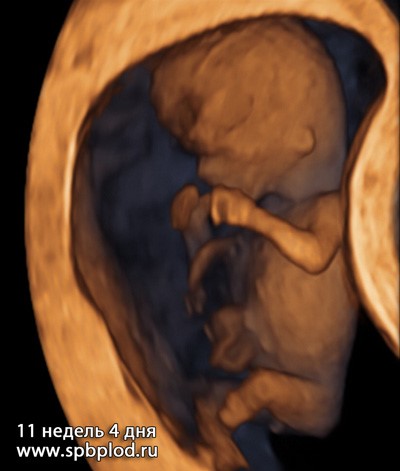 13-16 недели беременности